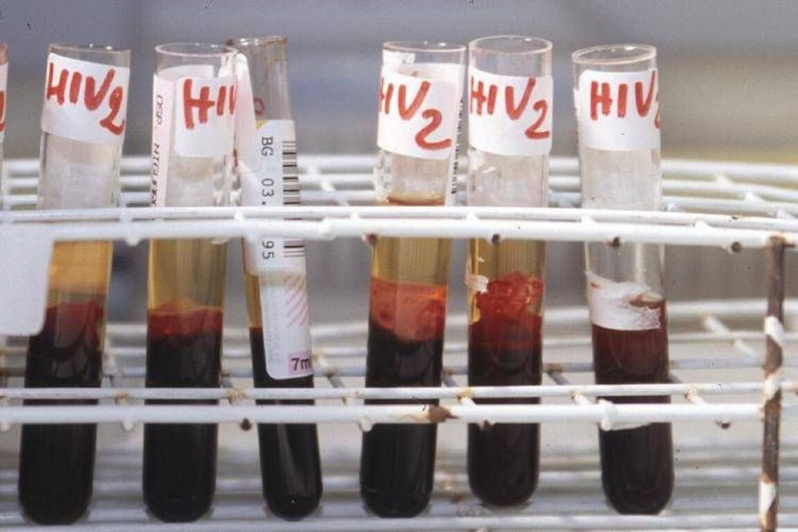Hiv, il 90% dei pazienti sceglie terapia long acting