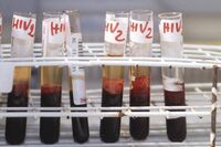 Hiv, il 90% dei pazienti sceglie terapia long acting