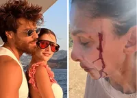 Can Yaman, la fidanzata Sara Bluma denuncia le violenze dell'ex. L'attore: "Ti amo"