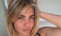 Martina De Ioannon sotto accusa per la “plastica in faccia”, la replica dell'ex tronista