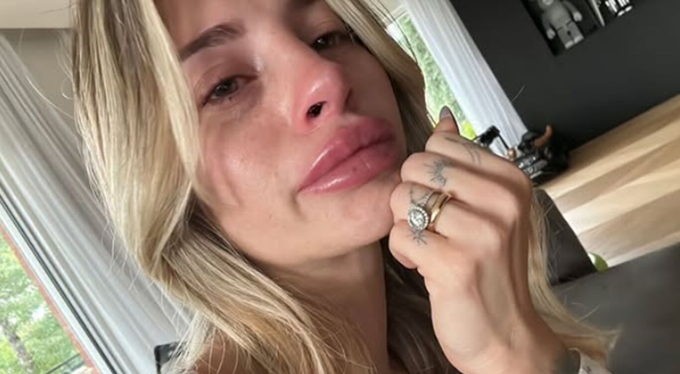 Chiara Nasti si mostra in lacrime sui social: il lato nascosto tra dolore, psicofarmaci e rinascita