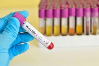 West Nile, Iss: "10 casi da inizio anno, 7 in provincia di Latina"