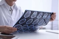 Sclerosi multipla e maternità, neurologa Marfia: "Personalizzare percorso"