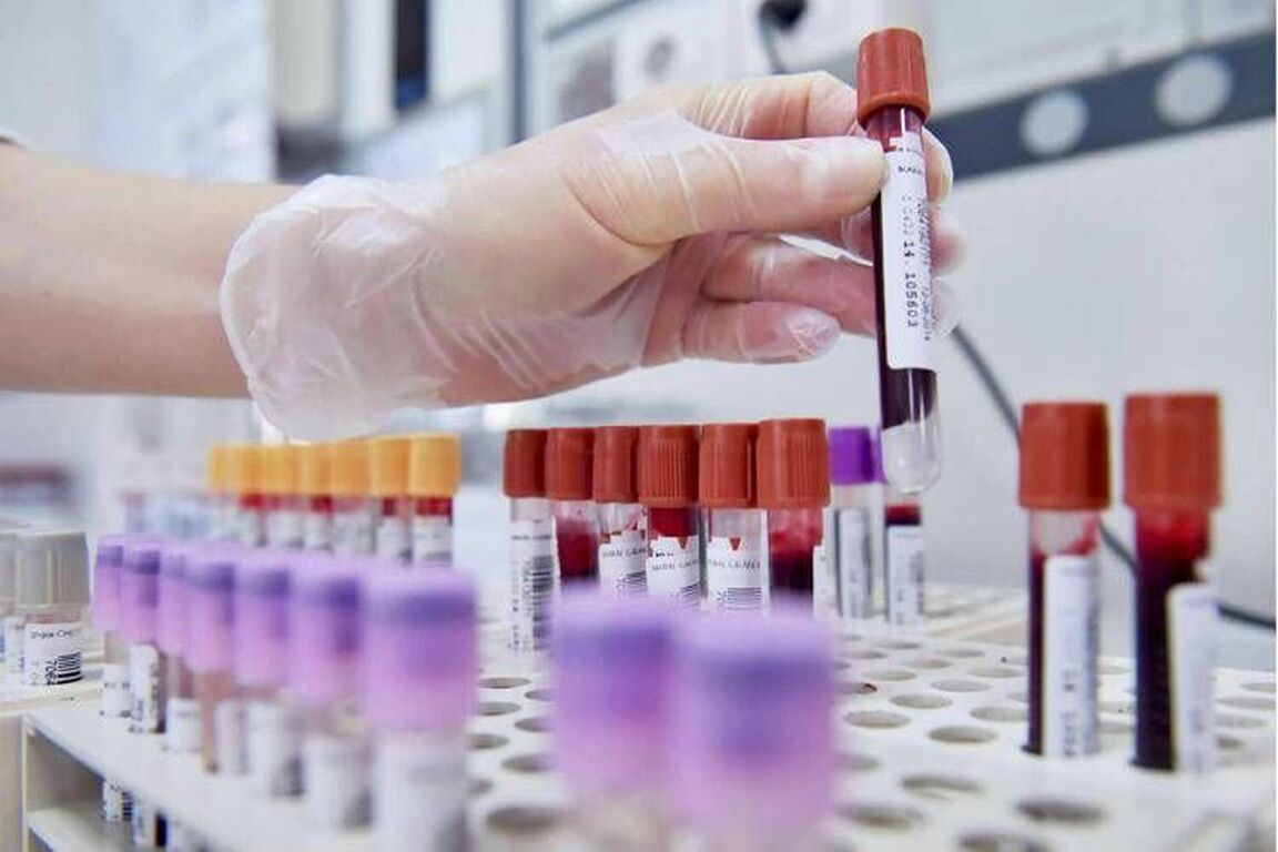 Dengue, un caso autoctono in Veneto. Salgono a 73 i casi di West Nile nel Lazio