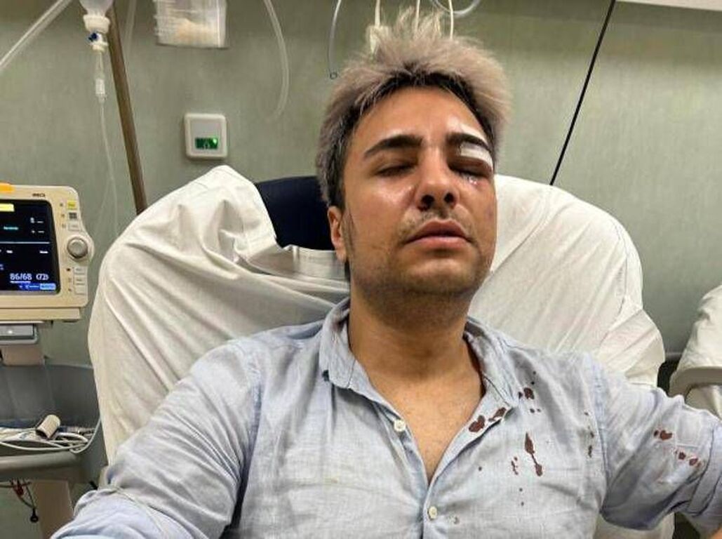 Roma, ancora un'aggressione omofoba: 25enne pestato dal branco