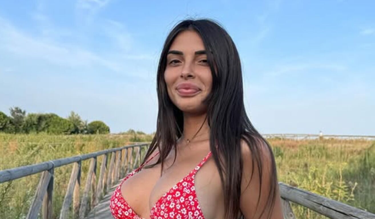 Grande Fratello, Greta Rossetti toglie il filler alle labbra: "I giudizi fanno male"