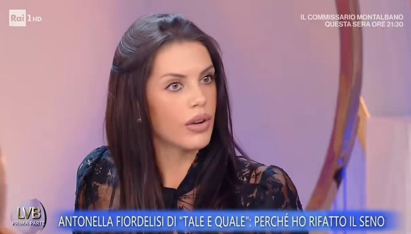 Antonella Fiordelisi: "Ho rifatto il seno, mi vedevo sproporzionata". Le foto del prima e dopo