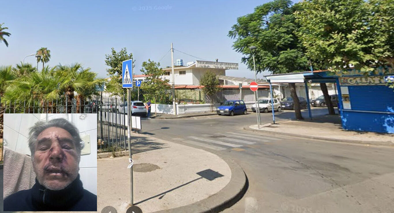 Incidente sul lungomare di Torre Annunziata, il pedone investito: “Salvo per la mia prontezza di riflessi”