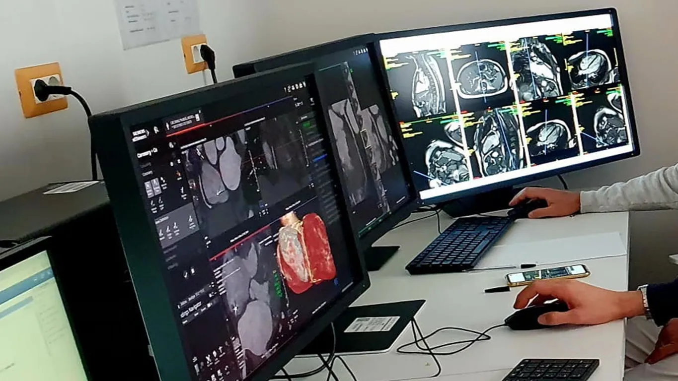 Ospedale di Nola, nuova diagnostica avanzata con TC photon counting