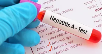 Epatite A, scatta l'ordinanza a Castellammare: stop ai frutti di mare crudi