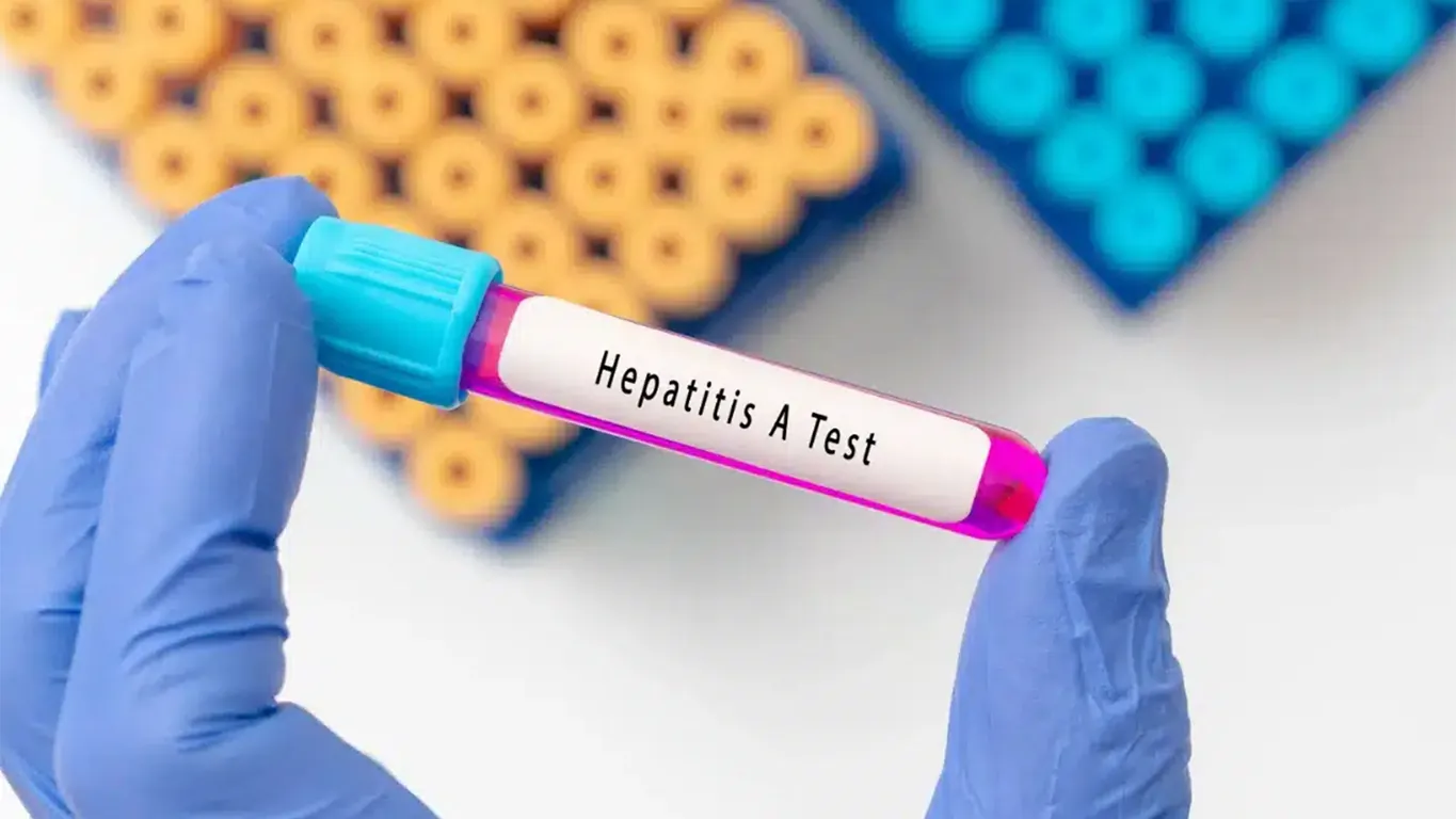 Torre del Geco, divieto assoluto di somministrazione e consumo frutti di mare crudi