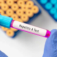 Torre del Geco, divieto assoluto di somministrazione e consumo frutti di mare crudi