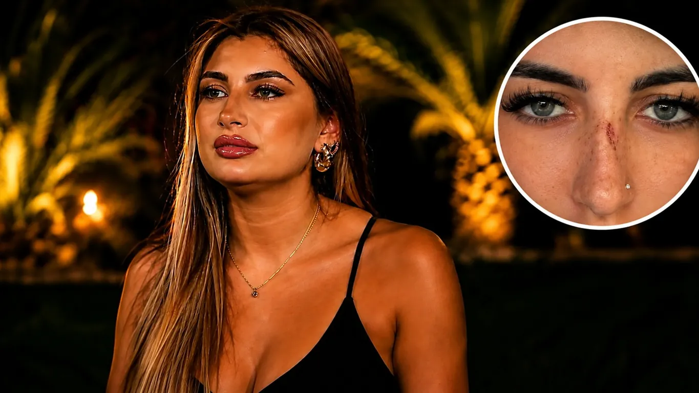 Temptation Island, Sabrina Soussi mostra il volto segnato: «Mi hanno aggredita». Cos'è successo