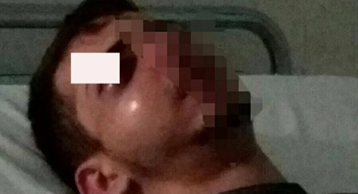 Torre Annunziata/Boscoreale - Pestato dal branco alla Stazione Circum, torna libero uno degli aggressori