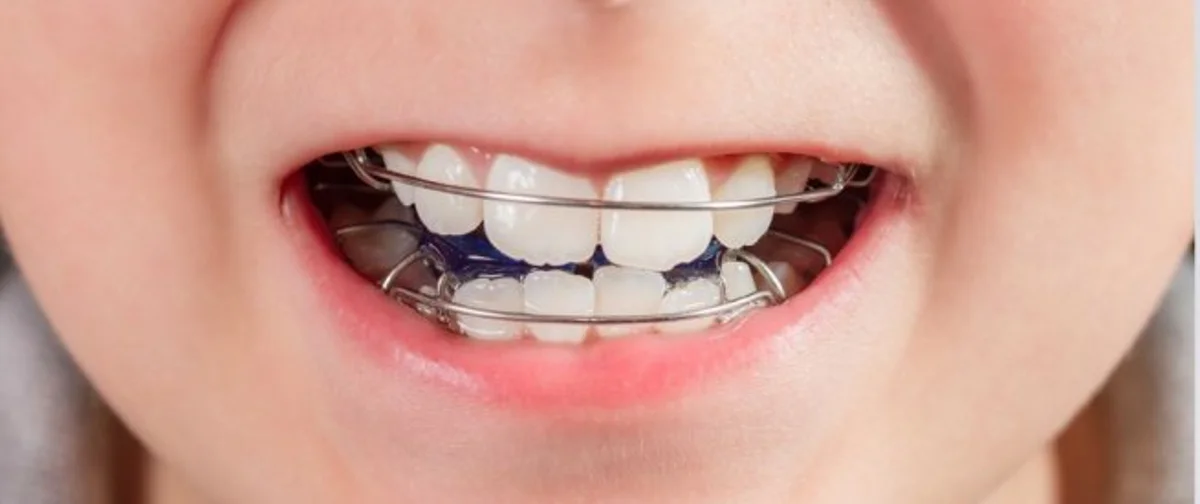 Torre Annunziata - Terapie ortodontiche e odontoiatriche gratuite per i ragazzi