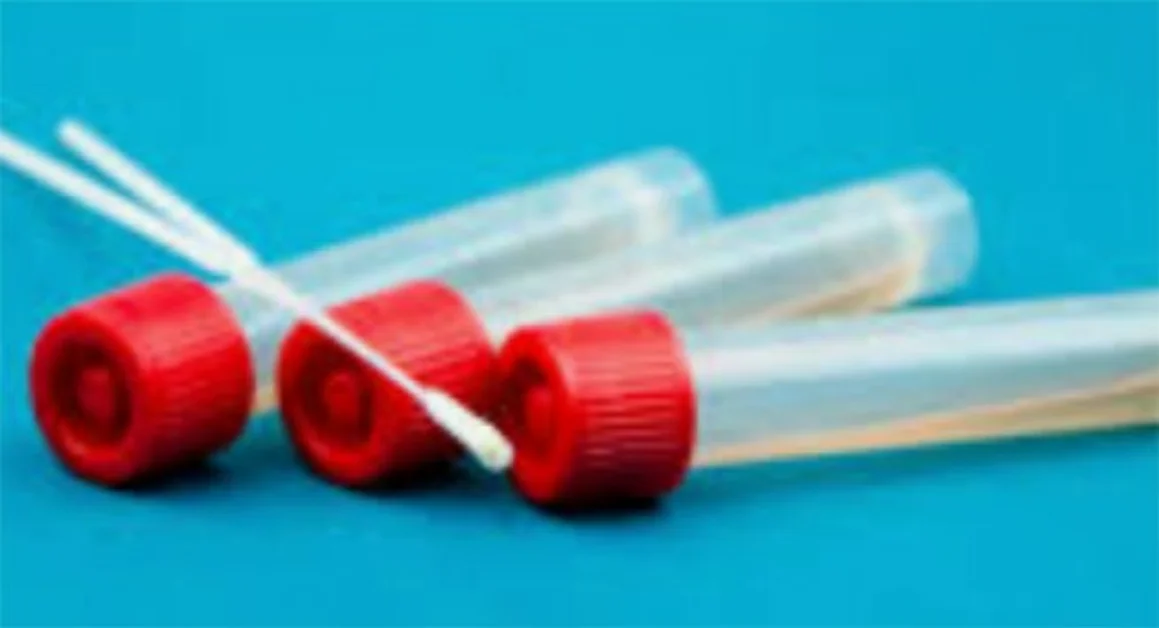 Coronavirus, l'esito dei tamponi effettuati al Cotugno nel pomeriggio dell'8 marzo