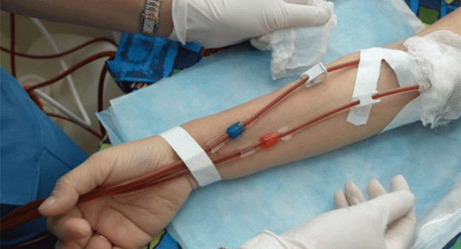 Dial-Vaccine-Day Asl Napoli 3 Sud domenica 28 Marzo 2021