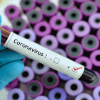 Torre del Greco - Coronavirus, altre 3 vittime e 18 nuovi contagi