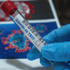 Torre Annunziata - Coronavirus, 16 casi in 3 giorni ma anche 8 guarigioni