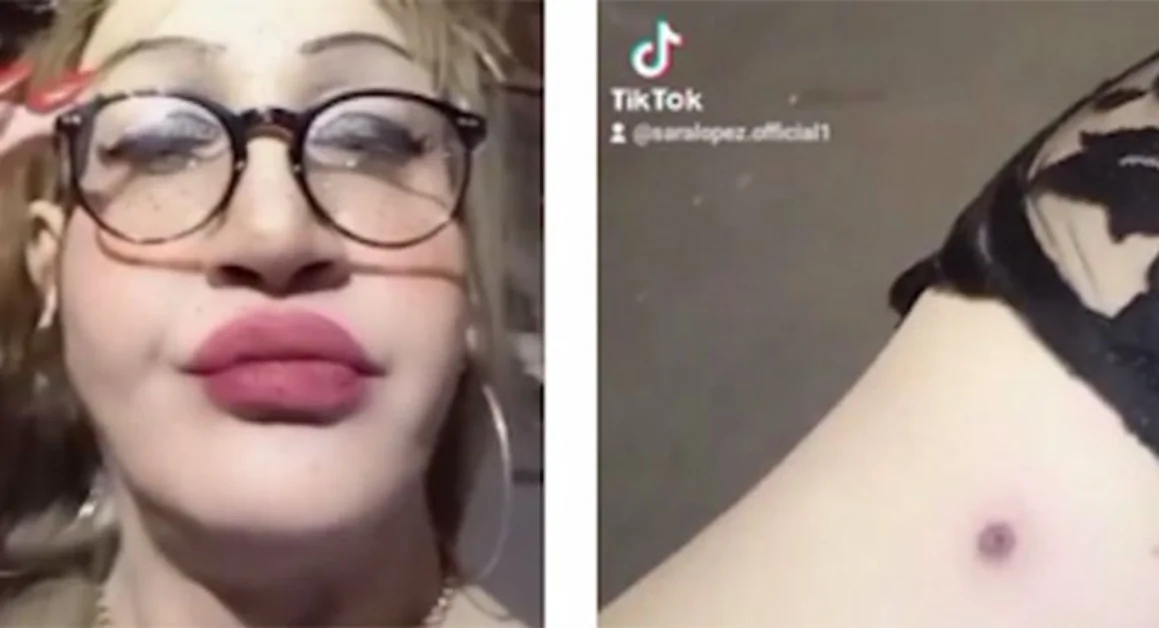 Torre Annunziata - Transgender aggredita, la solidarietà dell'Amministrazione comunale