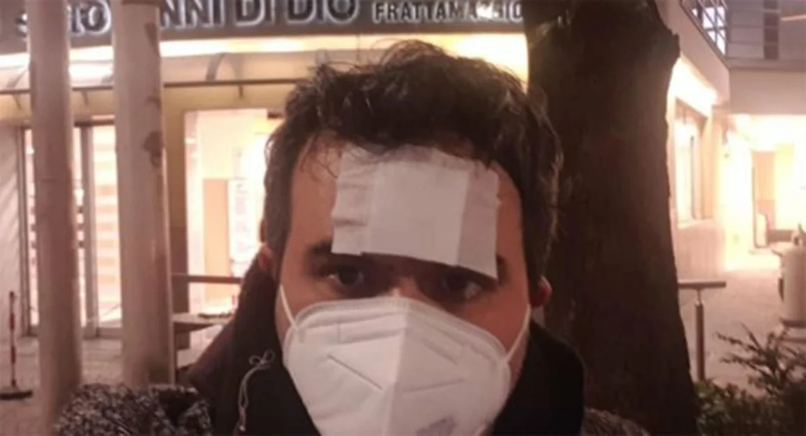 Professore pestato a Casavatore, identificati due presunti aggressori