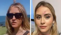 Valentina Ferragni dopo il tumore della pelle: "Ero terrorizzata dal sole"