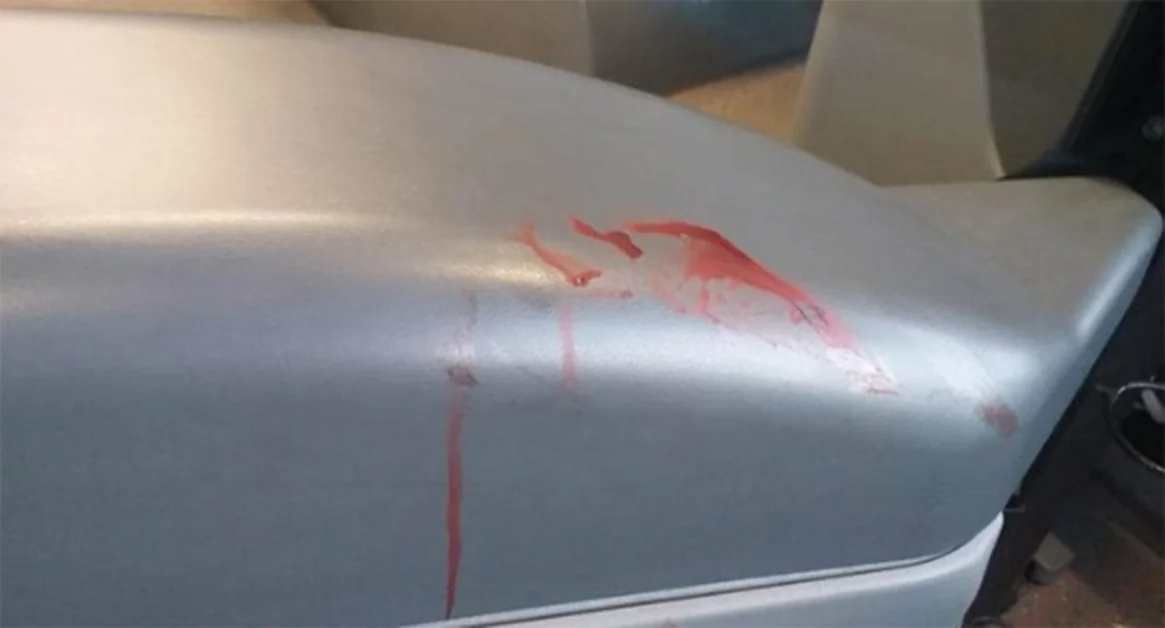 Castellammare di Stabia - Autista EAV aggredito da automobilista