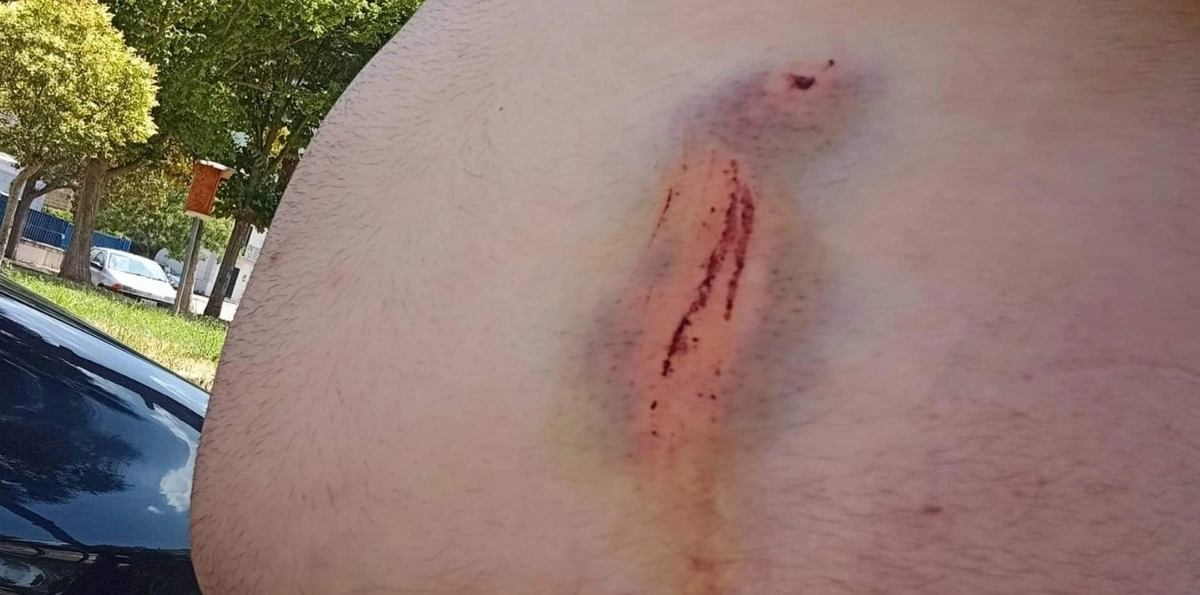 Violenza cieca nel Napoletano, presi a sprangate per un  parcheggio