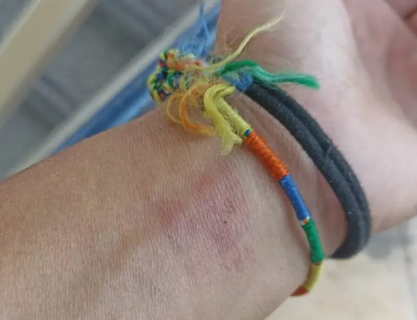 Minacciate e aggredite perché avevano relazione omosessuale, padre non la accettava