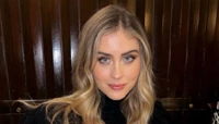 Valentina Ferragni sulla cicatrice alla fronte: "E' diventata parte di me"