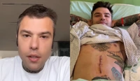 Fedez di nuovo sotto ai ferri. Operazione top secret alla pancia