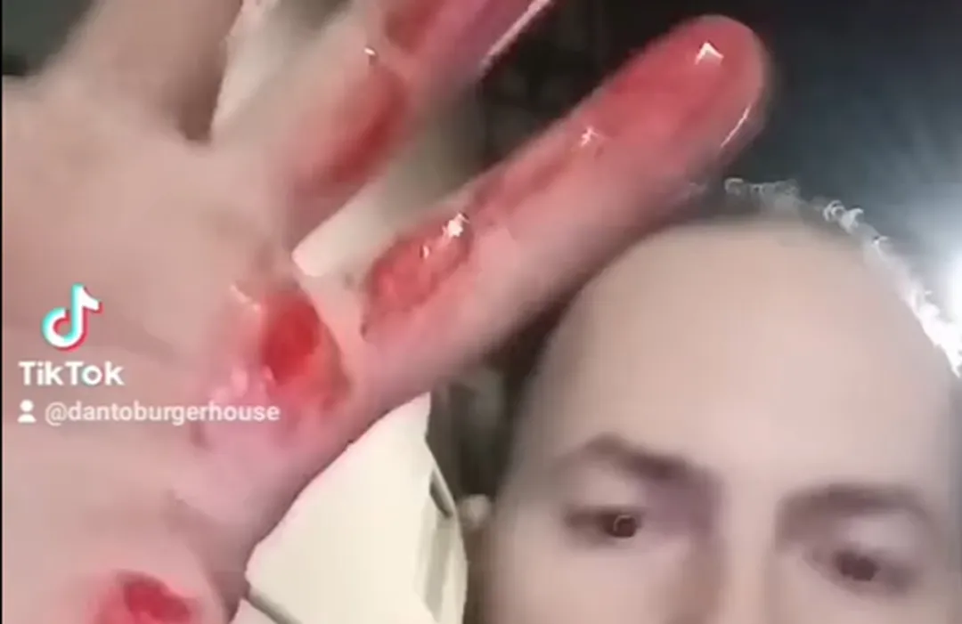 Torre Annunziata - Video choc di un commerciante rapinato e ferito al capo