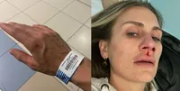 Gf Vip, cos'è accaduto a Nikita Pelizon: "Il sangue e poi la corsa in ospedale"