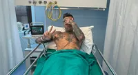 Fedez finisce di nuovo in ospedale: "Un'altra emorragia interna"