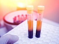 Farmaci, Sava (Sif Magazine): "In plasmaderivati attenzione particolare a sicurezza"
