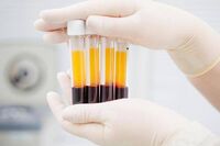 Plasmaderivati, Lecci (Sda Bocconi): "Serve un'innovazione rapida meno costosa"