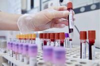 Sibioc, su ipotesi Regione Lazio: "No esternalizzazione medicina di laboratorio"
